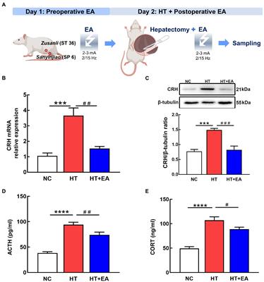 Electroacupuncture alleviates perioperative hypothalamus-pituitary-adrenal axis dysfunction via circRNA-miRNA-mRNA networks